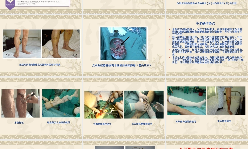 南昌大隐静脉曲张.ppt
