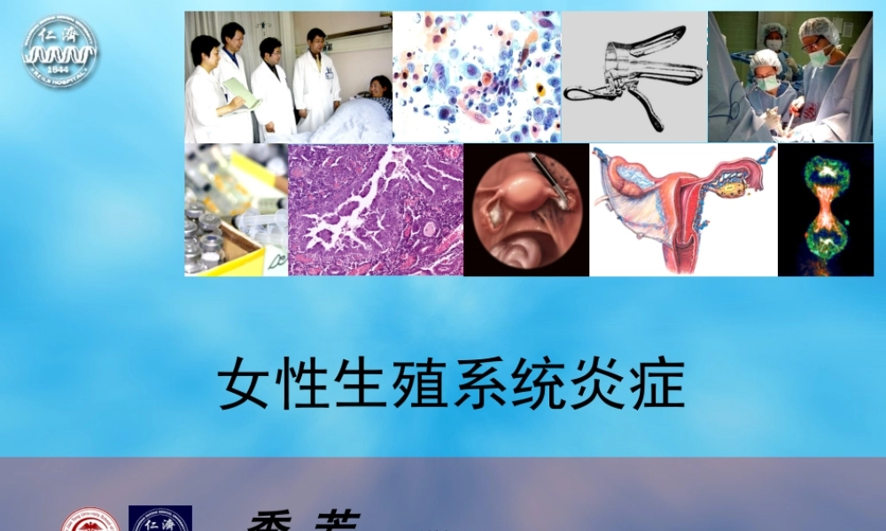 女性生殖系统炎症.ppt