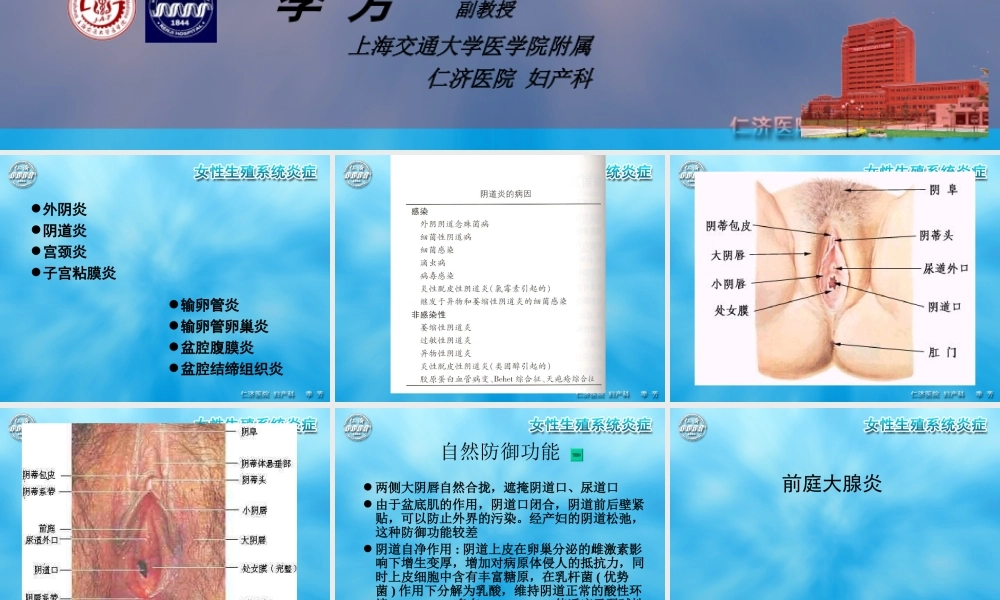 女性生殖系统炎症.ppt