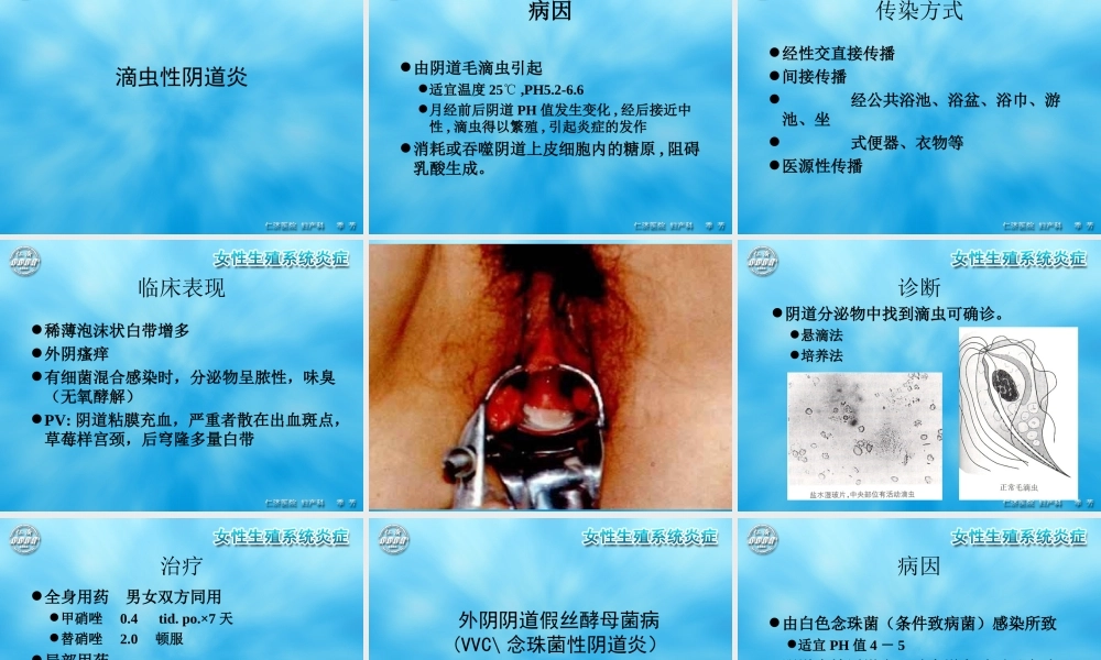 女性生殖系统炎症.ppt
