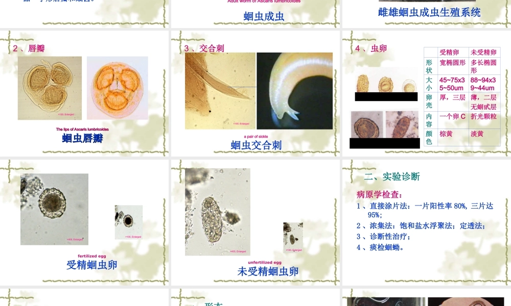 医本一蛔虫钩虫鞭虫蛲虫.ppt