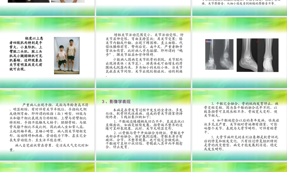 大骨节病基本知识.ppt