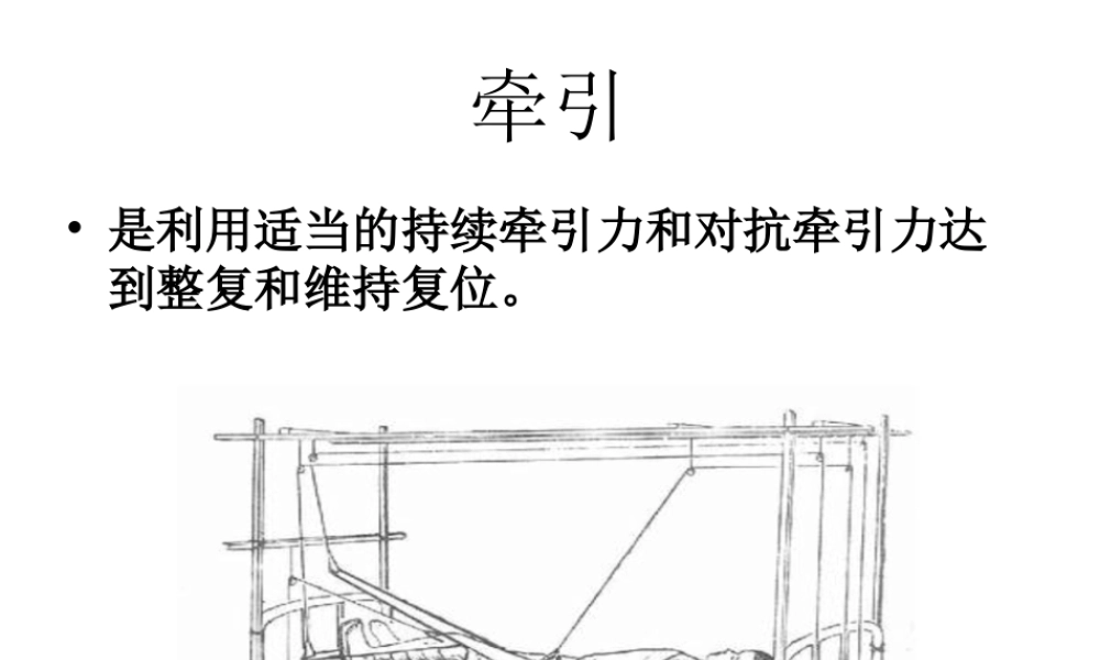 如小儿股骨干骨折用垂直悬吊皮牵引.ppt