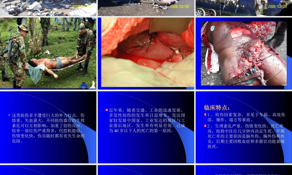 多发性创伤的处理.ppt