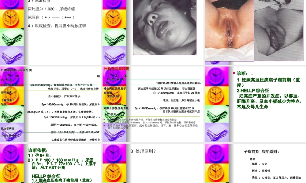 妊高症病例分析.ppt