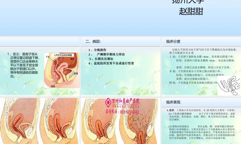 子宫脱垂.pptztt.ppt