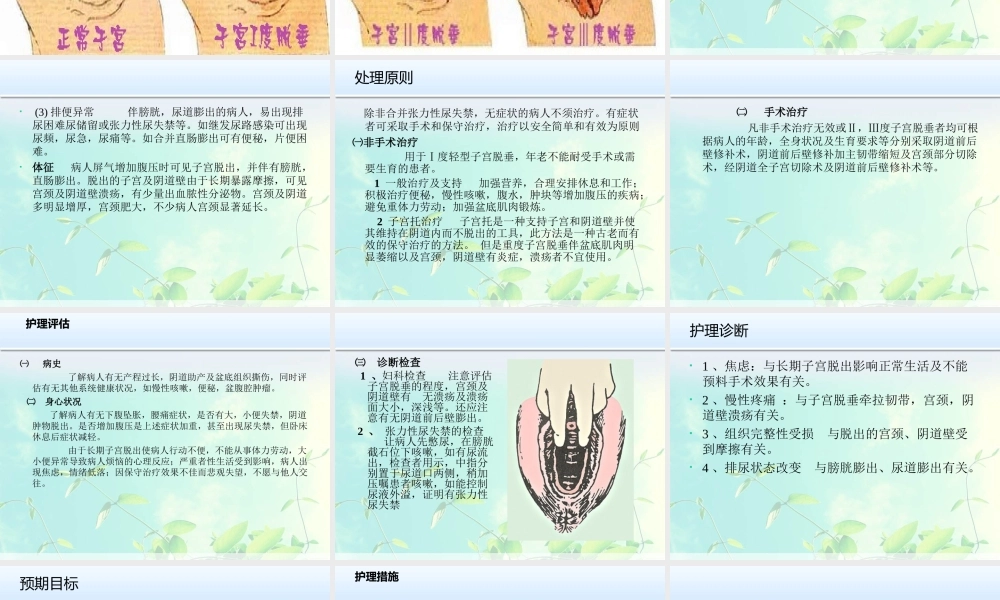 子宫脱垂.pptztt.ppt