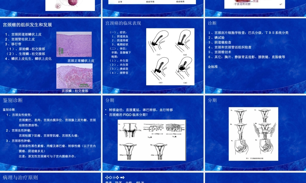 子宫肌瘤的分类.ppt