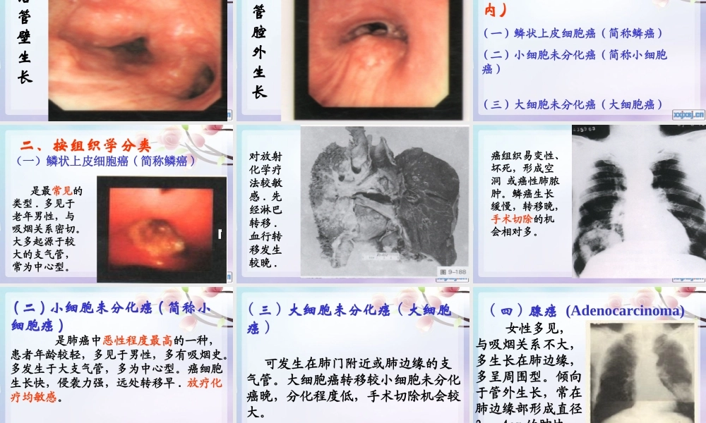 原发支气管肺癌1.ppt