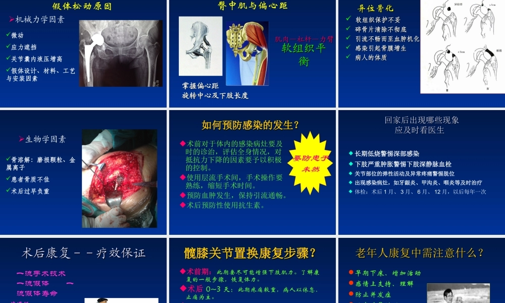 如何延长人工关节的寿命.ppt