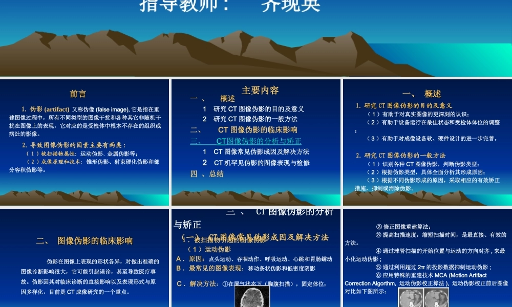 医用CT图像伪影成因.ppt