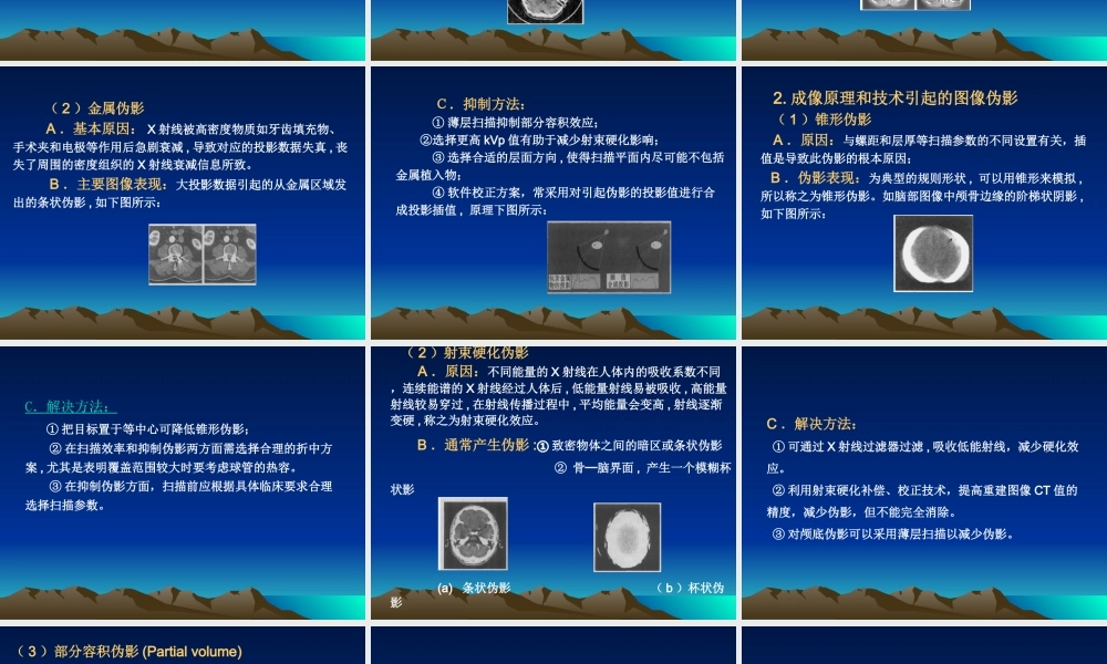 医用CT图像伪影成因.ppt