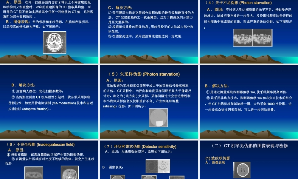 医用CT图像伪影成因.ppt