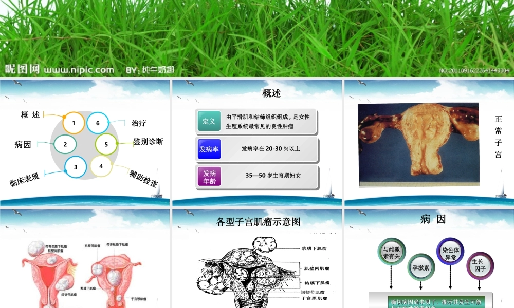 子宫肌瘤的诊治.ppt