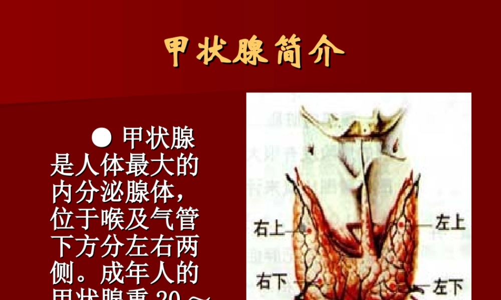 单纯性甲状腺肿PPT.ppt