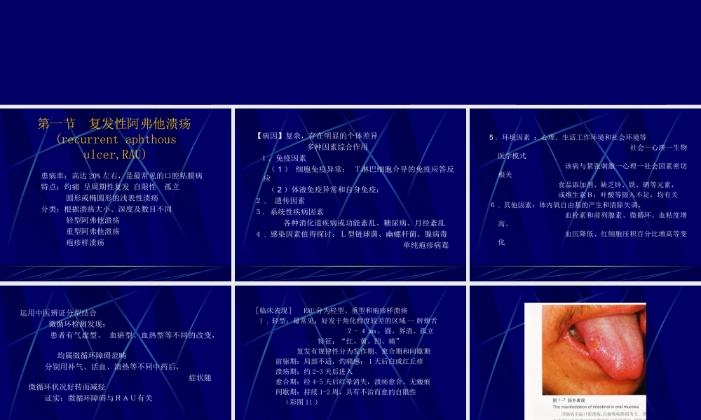 口腔溃疡[1].ppt.ppt
