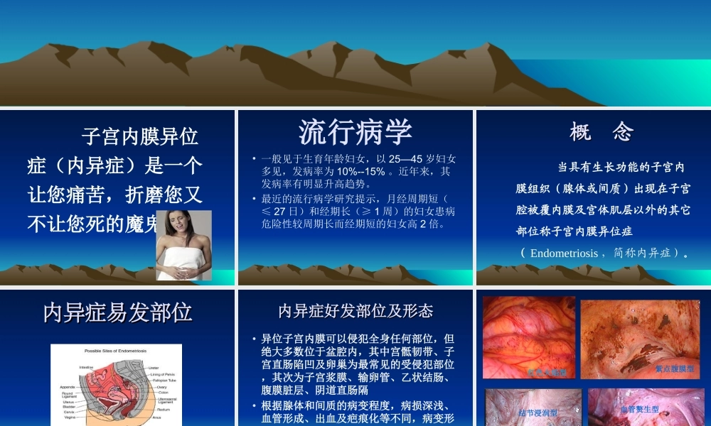 子宫内膜异位症(1).ppt