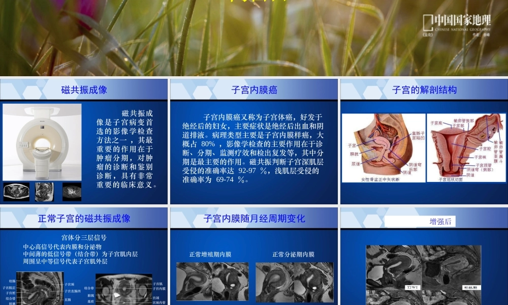 子宫内膜癌MRI影像表现.ppt
