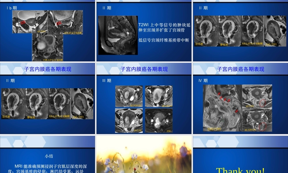 子宫内膜癌MRI影像表现.ppt