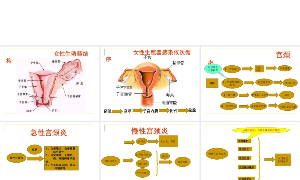 宫颈炎、附件炎、盆腔炎....ppt