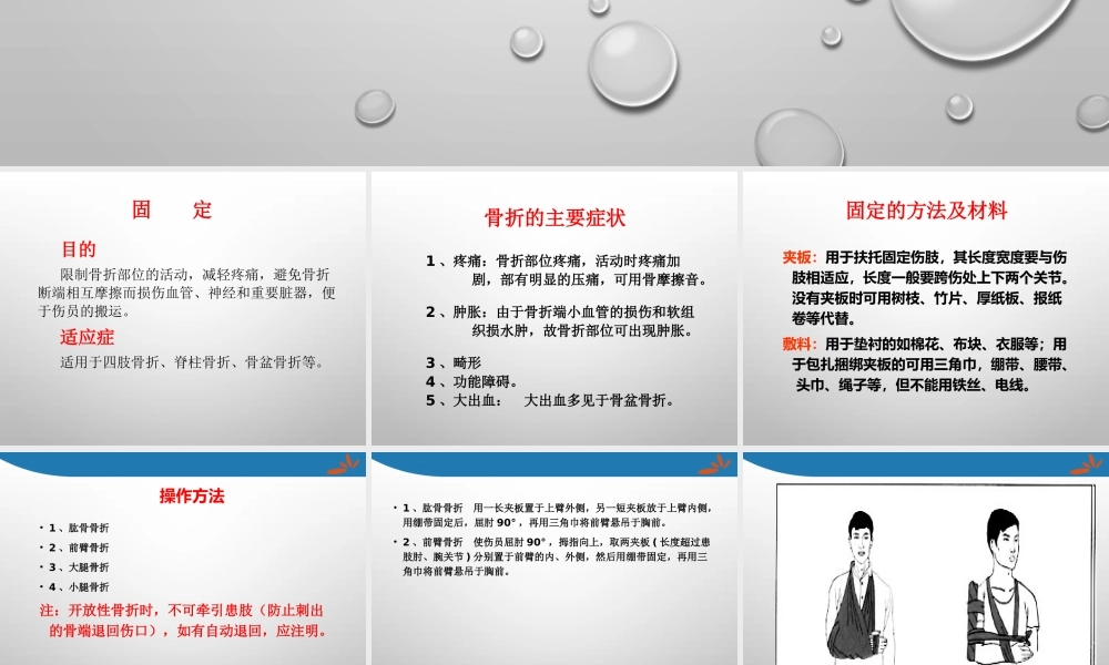 四肢骨折的固定搬运.pptx