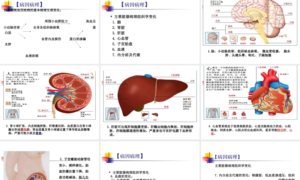 妊娠高血压综合征ppt.ppt