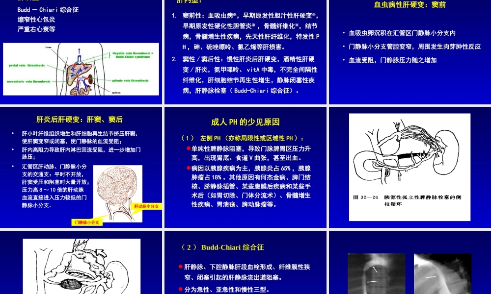 孙殿兴-门静脉高压症2013-12-07.ppt