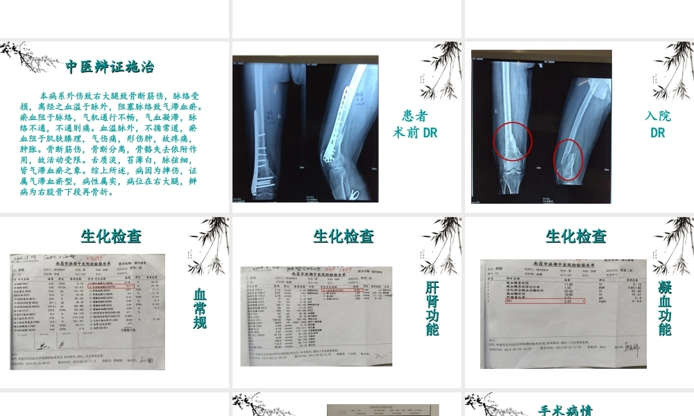 定稿(2014.06.19)[股骨干骨折术后再骨折-业务查房].ppt