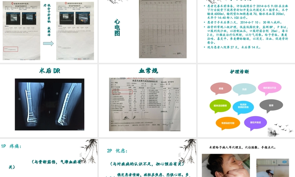 定稿(2014.06.19)[股骨干骨折术后再骨折-业务查房].ppt