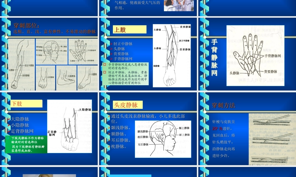 密闭式静脉输液法(护).ppt