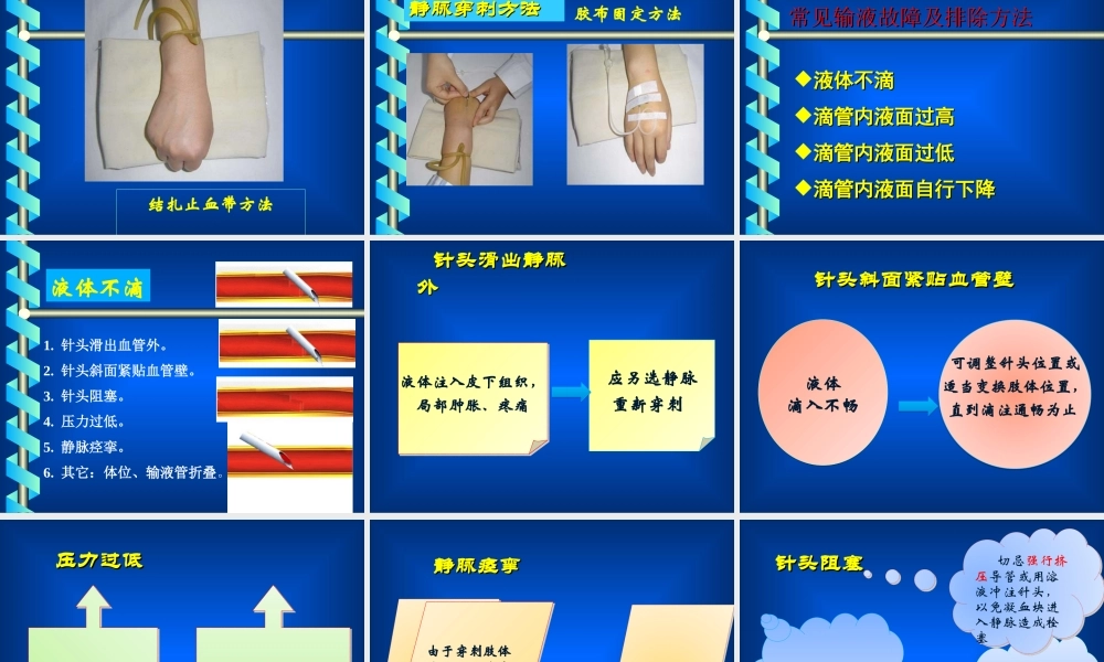 密闭式静脉输液法(护).ppt