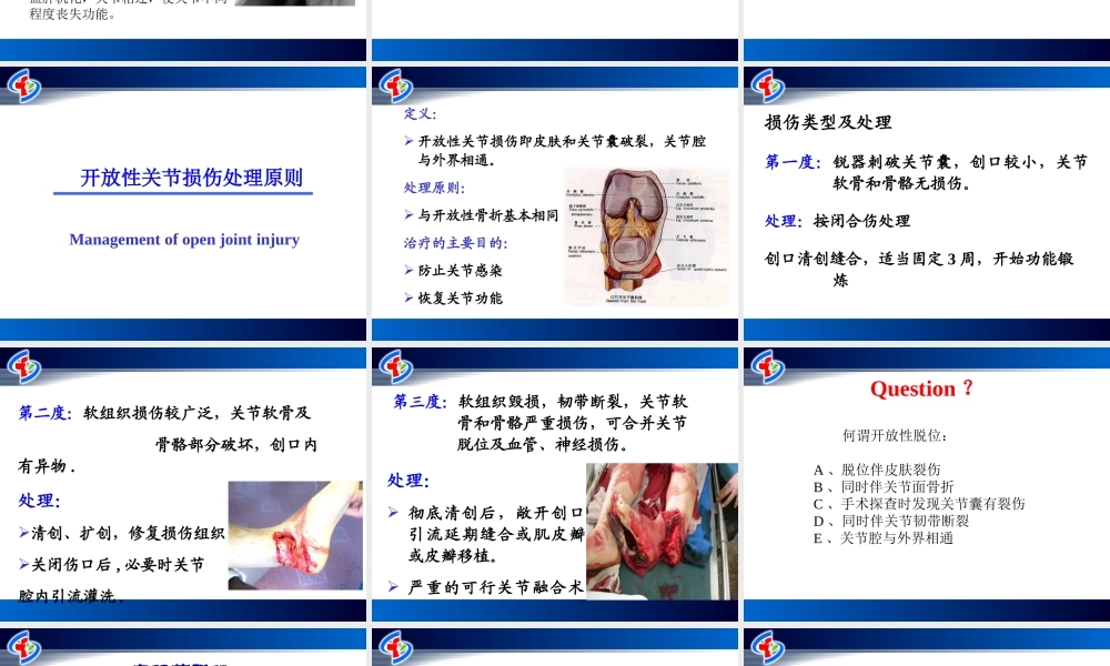 关节损伤和脱位.ppt