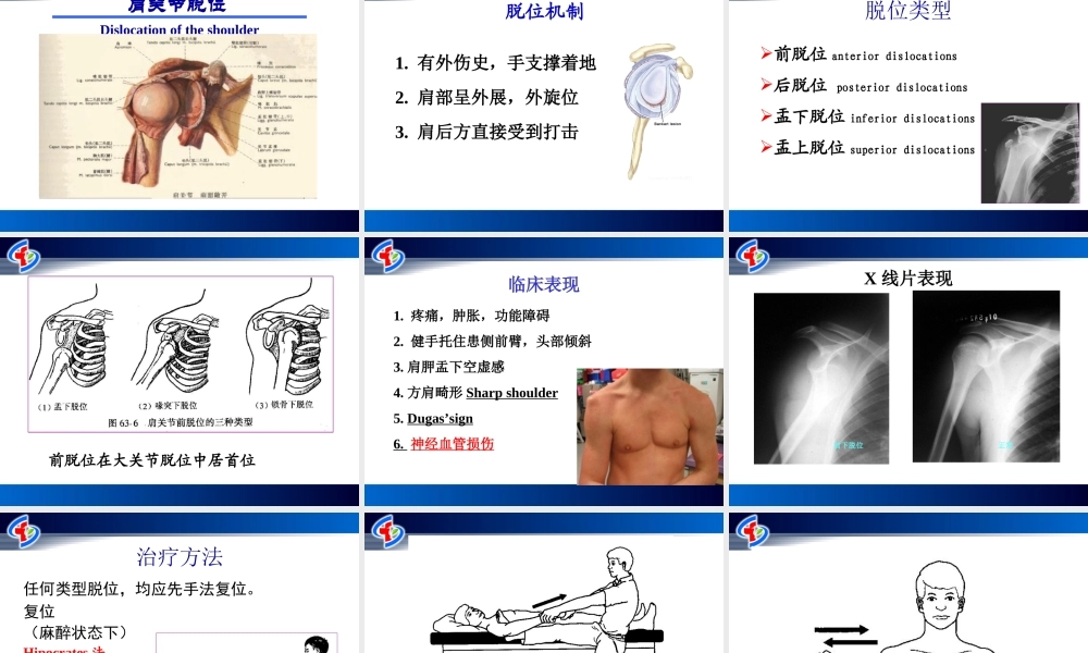 关节损伤和脱位.ppt