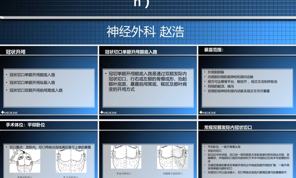 冠切开颅额下入路.ppt