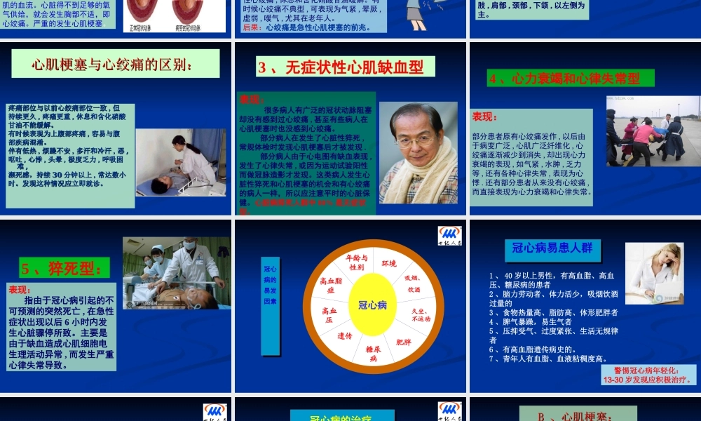 冠心病-2.ppt