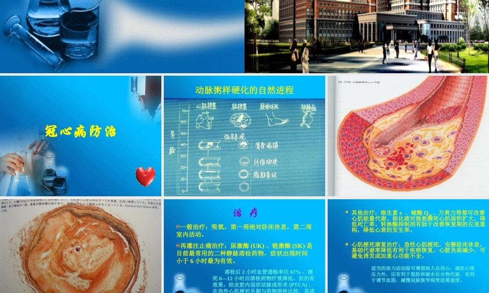 冠心病防治ppt..ppt