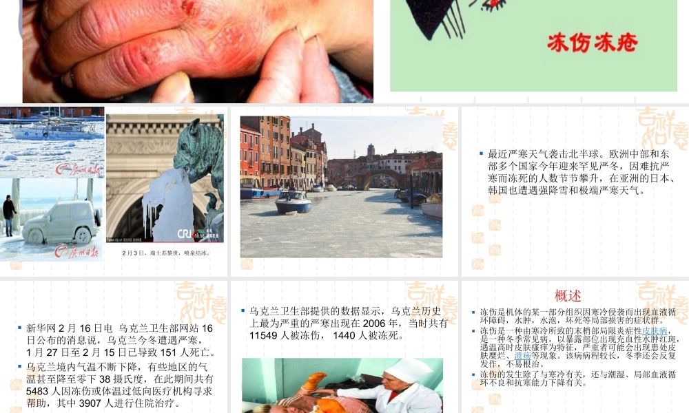 冻伤急救.ppt