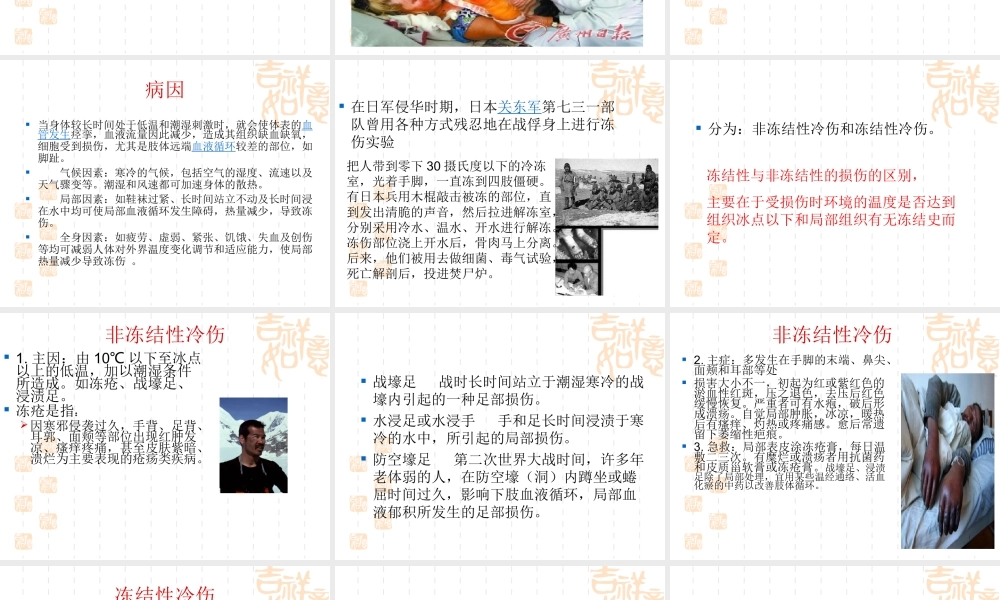 冻伤急救.ppt