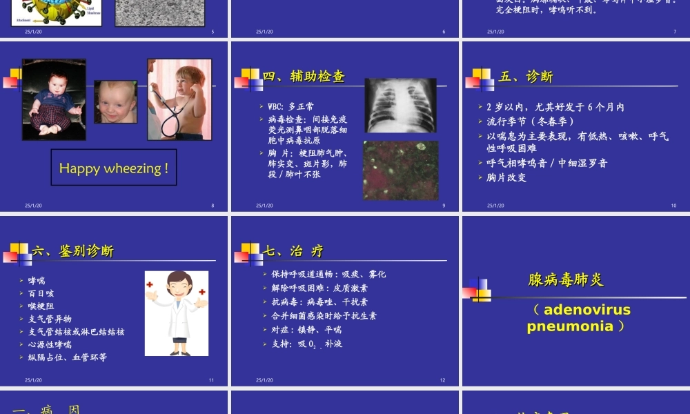 几种不同病原肺炎新模板.ppt