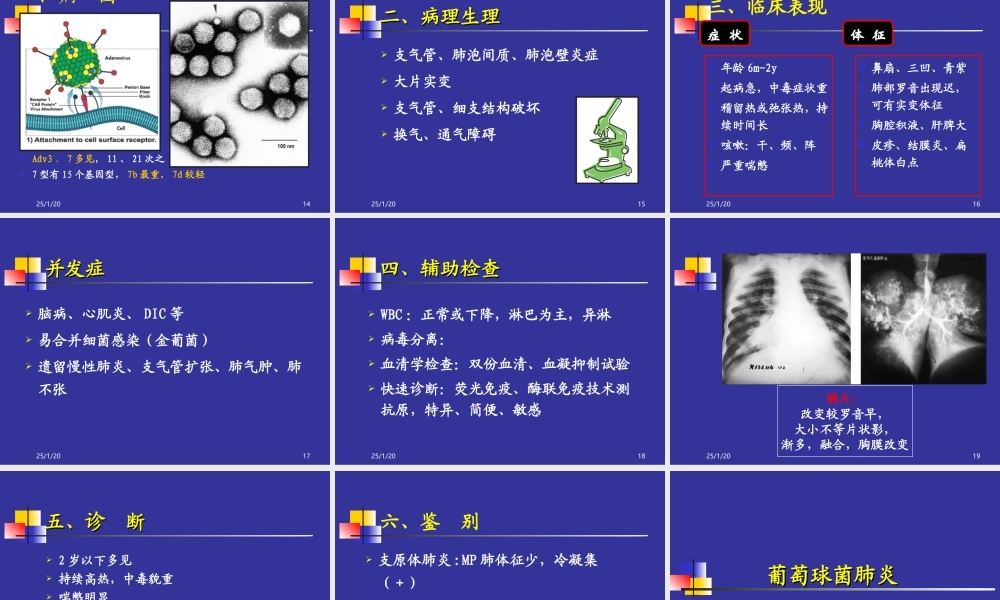 几种不同病原肺炎新模板.ppt