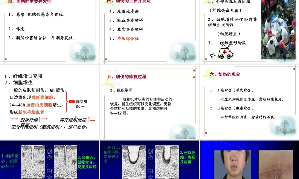 创伤与战伤吴.ppt