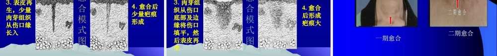 创伤与战伤吴.ppt