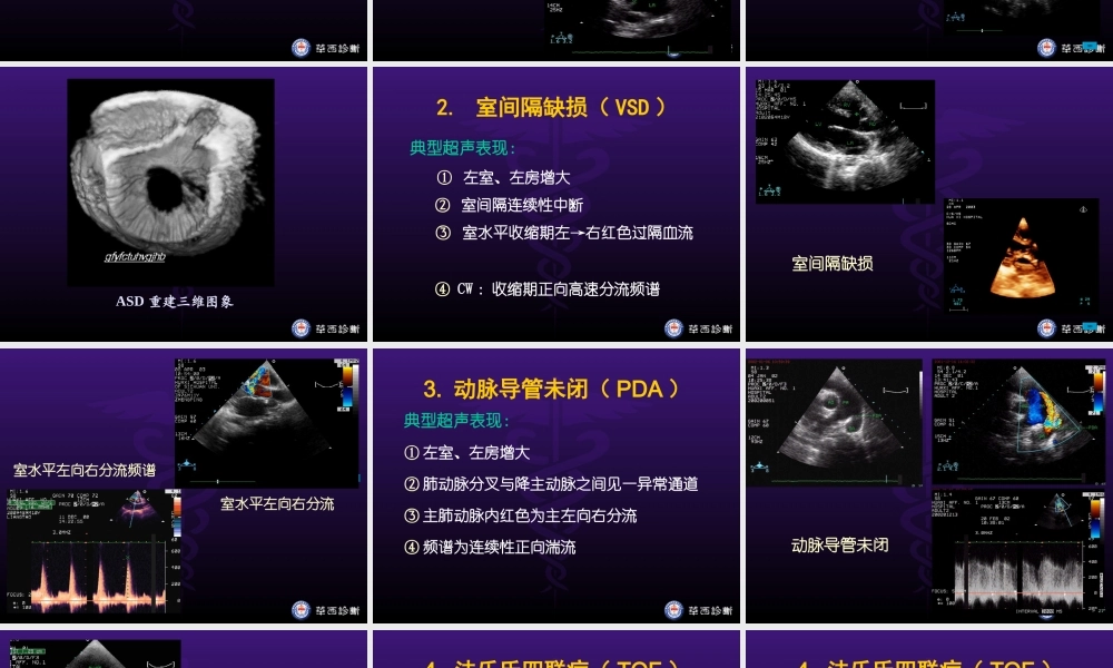 华西医科大精品课程-超声心动图3-异常.ppt