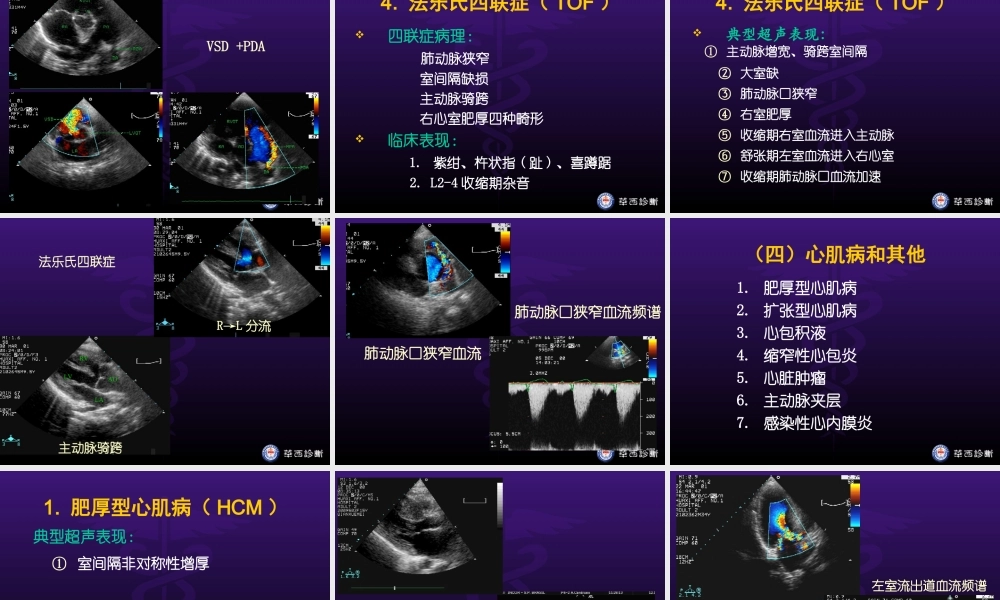 华西医科大精品课程-超声心动图3-异常.ppt