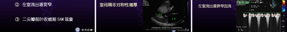 华西医科大精品课程-超声心动图3-异常.ppt
