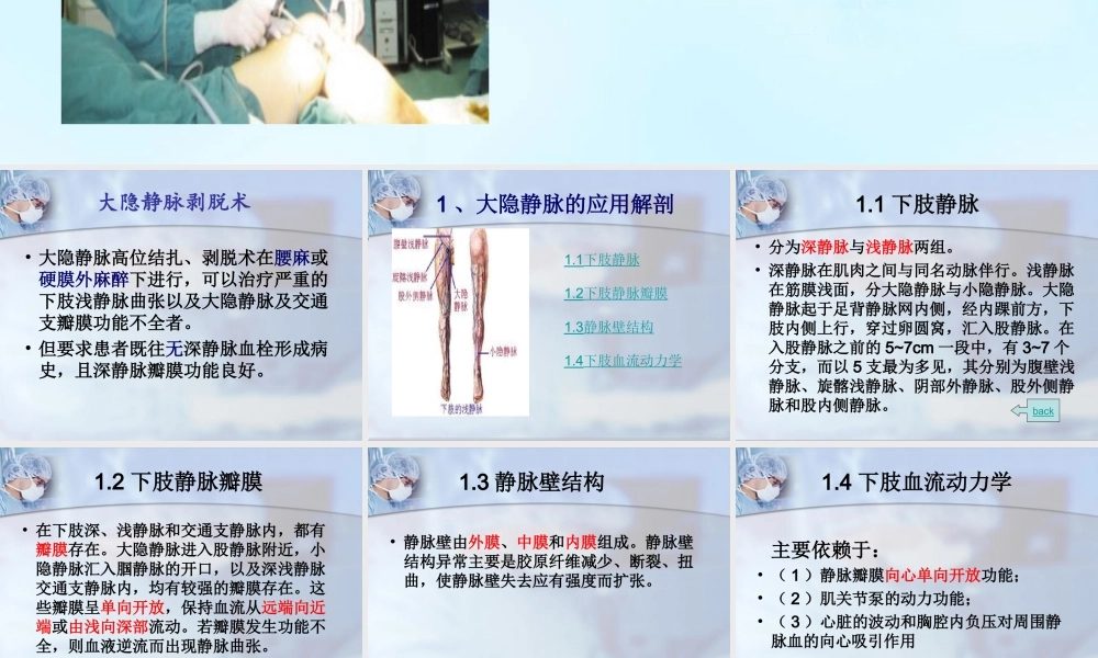 大隐静脉剥脱术.ppt