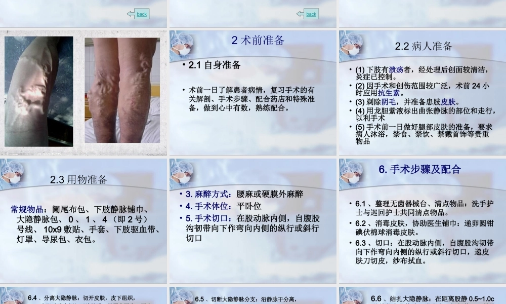 大隐静脉剥脱术.ppt