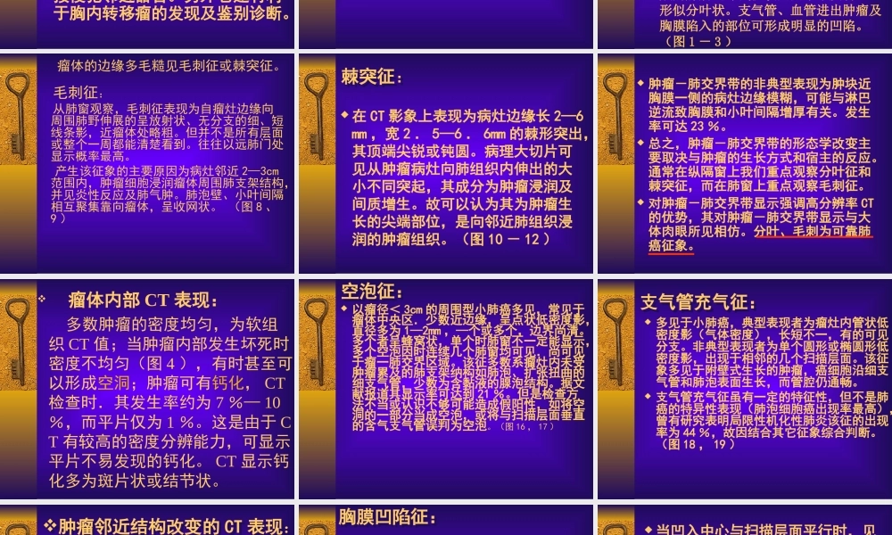 周围型肺癌CT征象分析.ppt