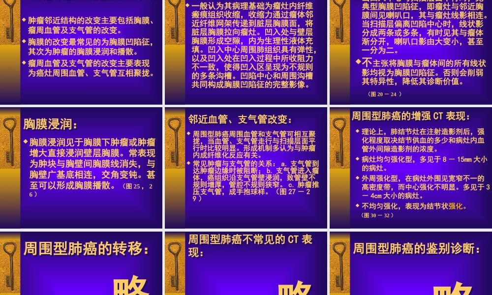 周围型肺癌CT征象分析.ppt