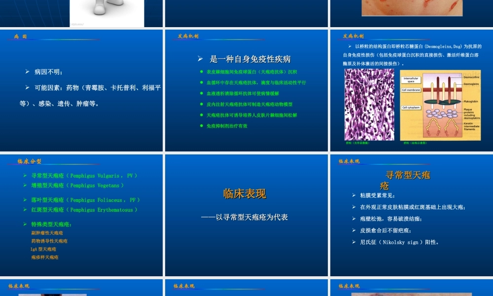 大疱性皮肤病.ppt